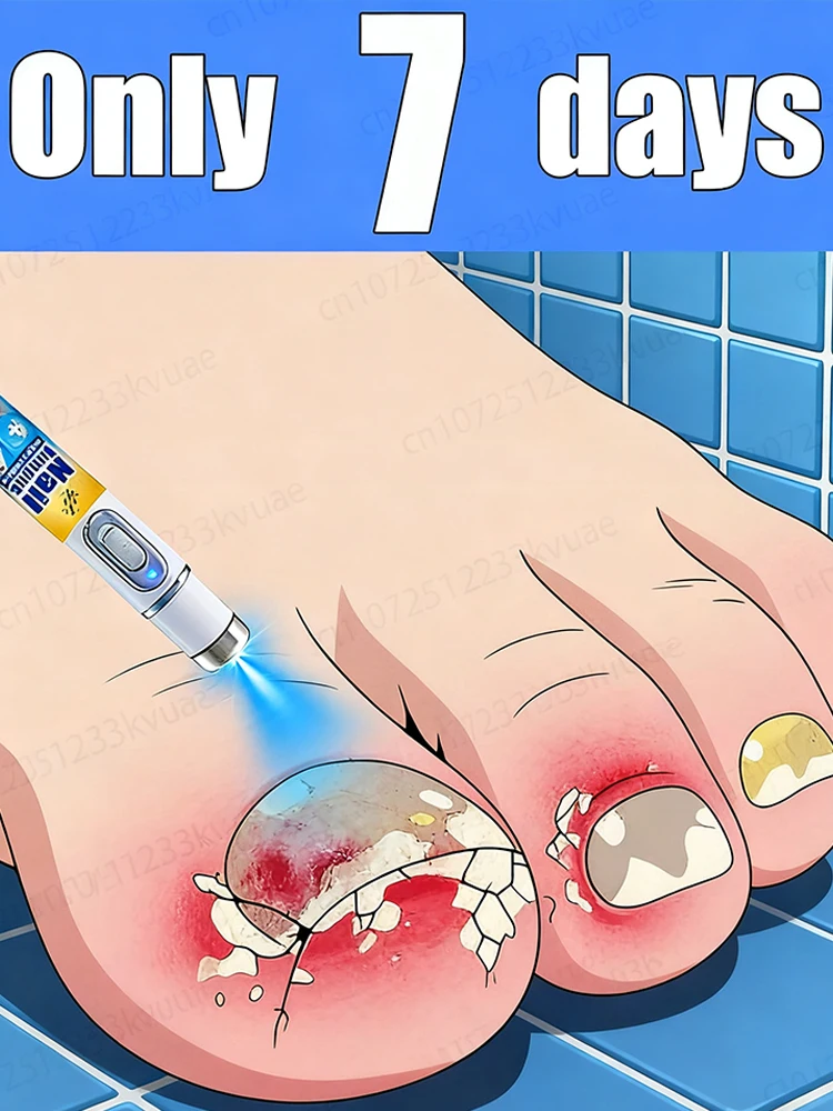 

Lᴀsᴇʀ ɴᴀɪʟ ғᴜɴɢᴜs ʀᴇᴍᴏᴠᴀʟ,ˢᵃᶠᵉ and ᶠᵃˢᵗ ᵉˡⁱᵐⁱⁿᵃᵗⁱᵒⁿ of onychomycosis