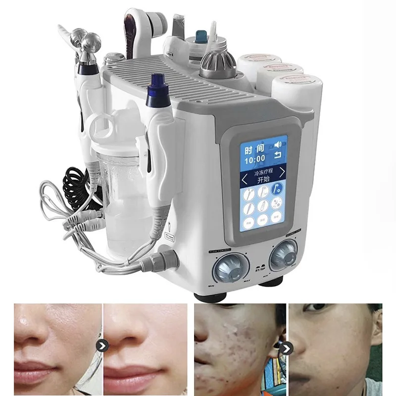 Hydrogen and oxygen small bubble beauty instrument, facial hydrogen cleansing skin management hydration and skin