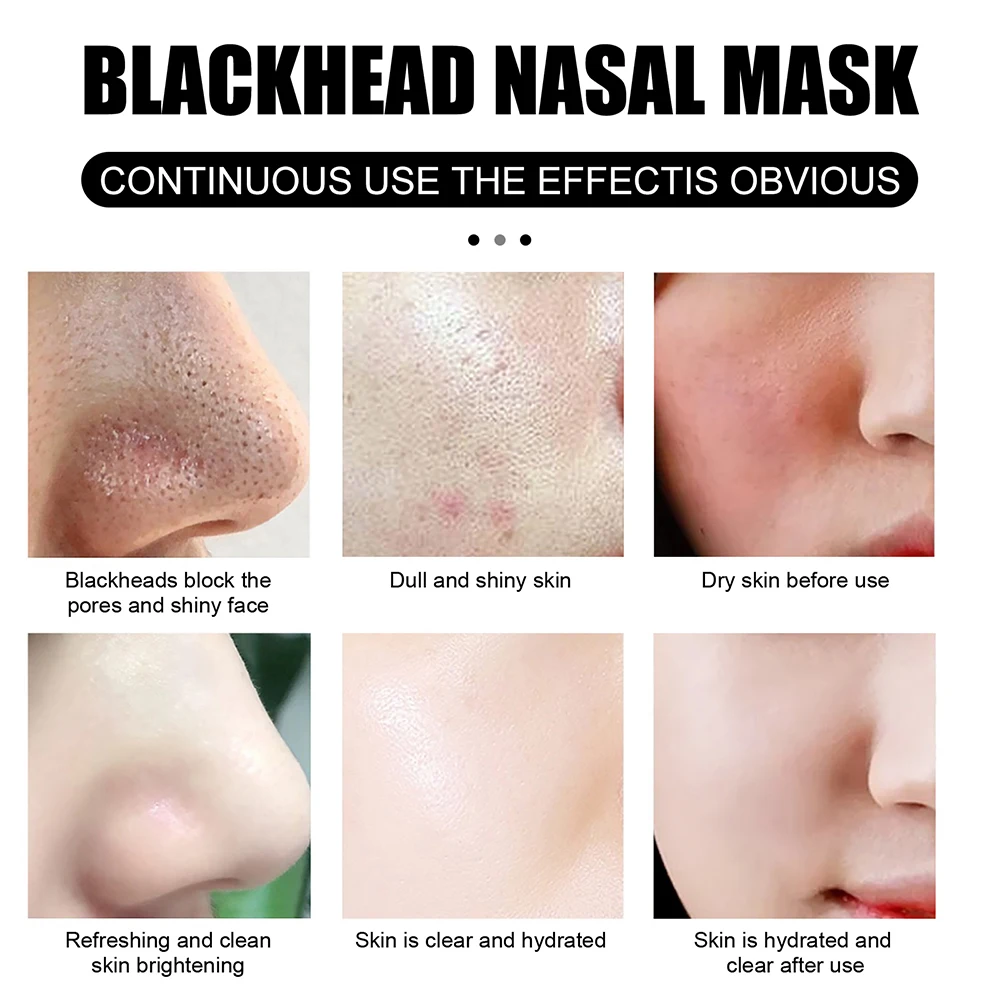 Blackhead Remover Mask Nose Mask Pore Strips Black Mask Peeling Acne Treatment Deep Cleansing Face Mask Oil Control Skin Care