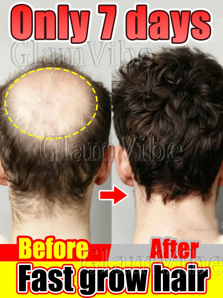 

Gᴇɴᴛʟᴇ ᴀɴᴅ non-irritating , promotes pore r̶e̶c̶o̶v̶e̶r̶y̶