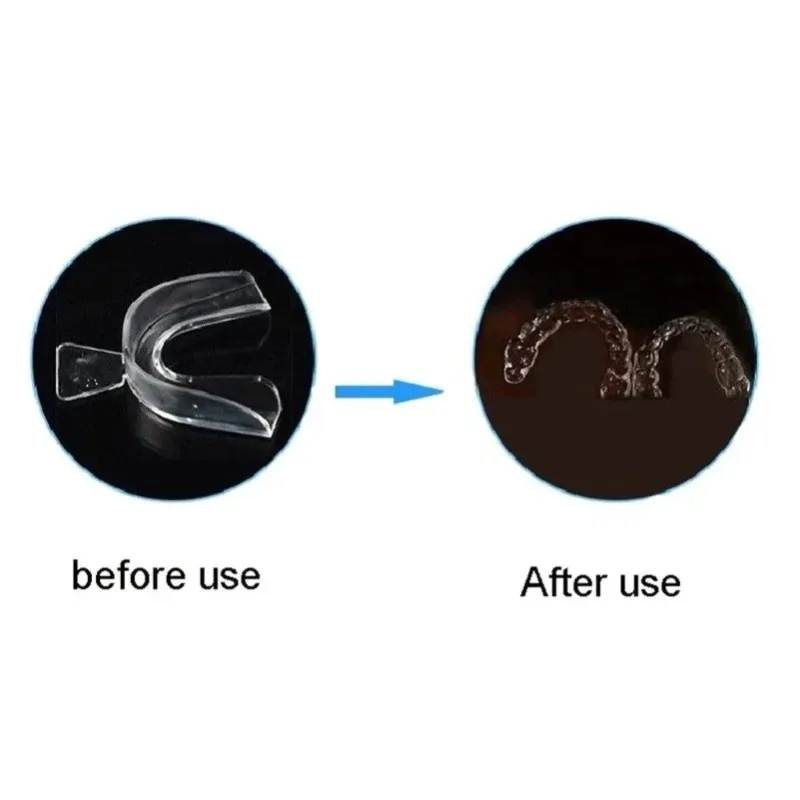 Anti Snoring & Teeth Grinding Mouth Guard 4