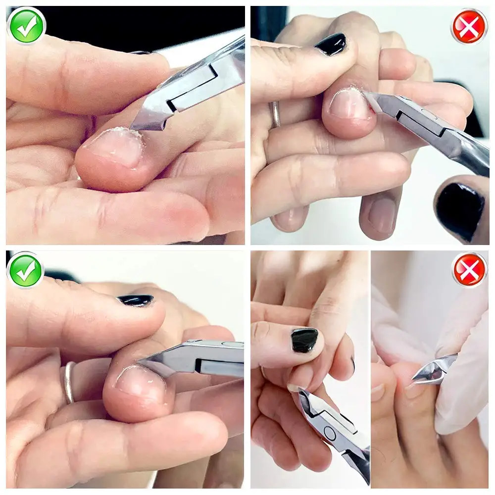 Pinza para cutículas de acero inoxidable, tijeras profesionales para quitar los dedos, cortaúñas para manicura, herramientas para la piel muerta, color dorado