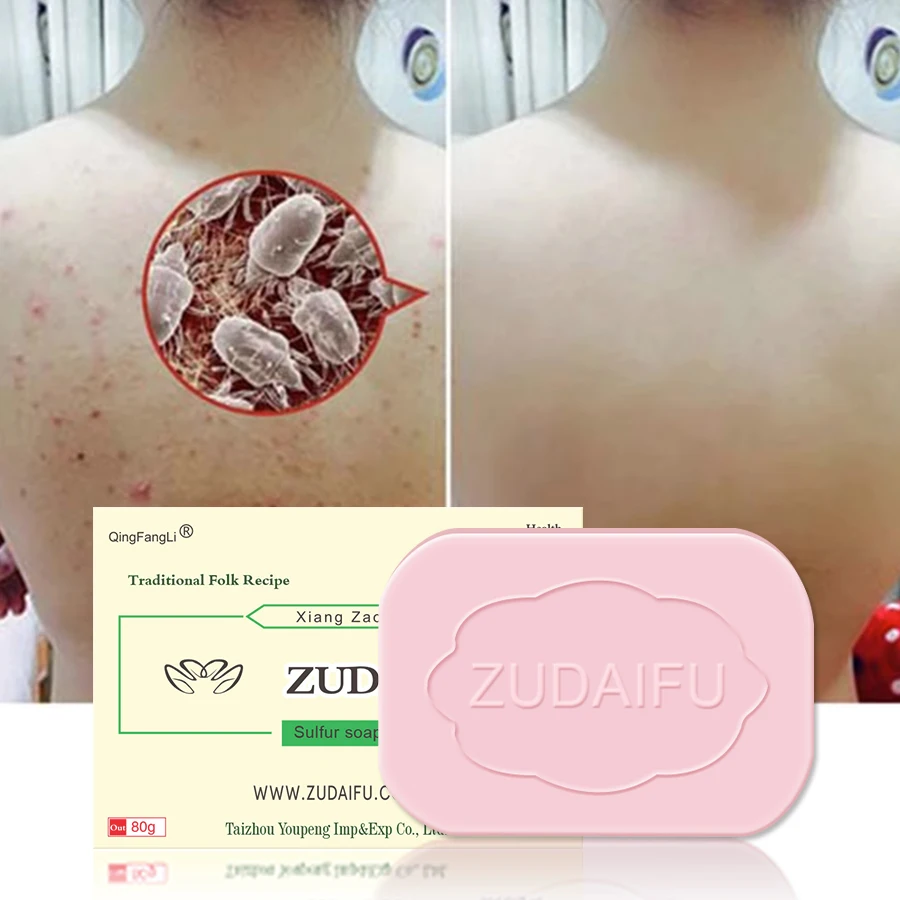 3Pcs ZUDAIFU Sulfur Soap Removal Pimple Acne Skin Conditions Perfume Bath Oil Control Health Care Soap 80g