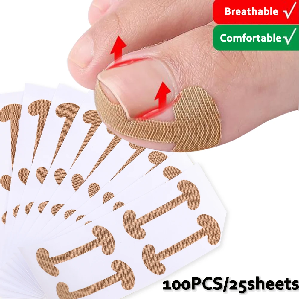 100pcs Ingrown Toenail Correction Strips Lasting Adhesion Waterproof Nail Correction Stickers Elasticity Toe Care Pedicure Tools