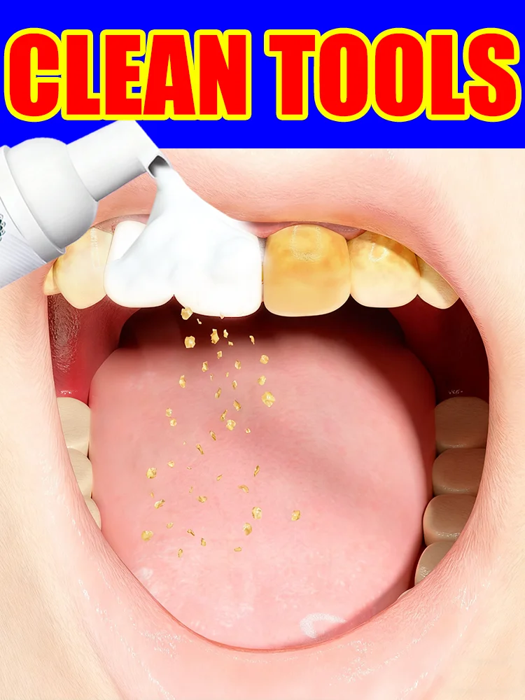 

[2025 Hotsale]Intraoral Mousse clean tools,Free shipping,New upgrade 3.0