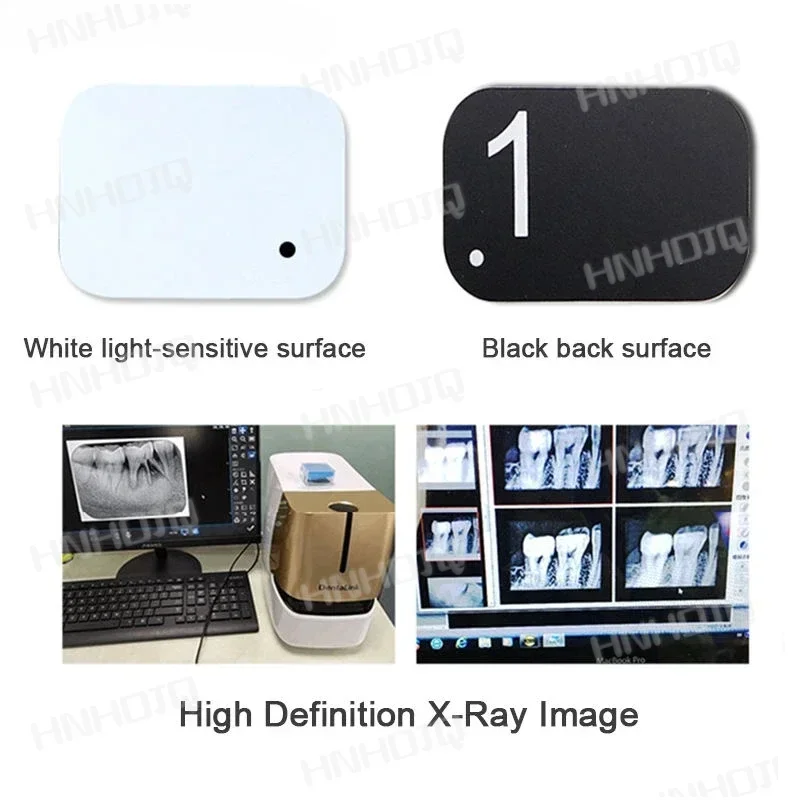 Dental X-Ray Scanner Intra Oral Phosphor Imaging Plates Xray Imaging Phosphor Storage Plates for General Scanner Dentist  Tool