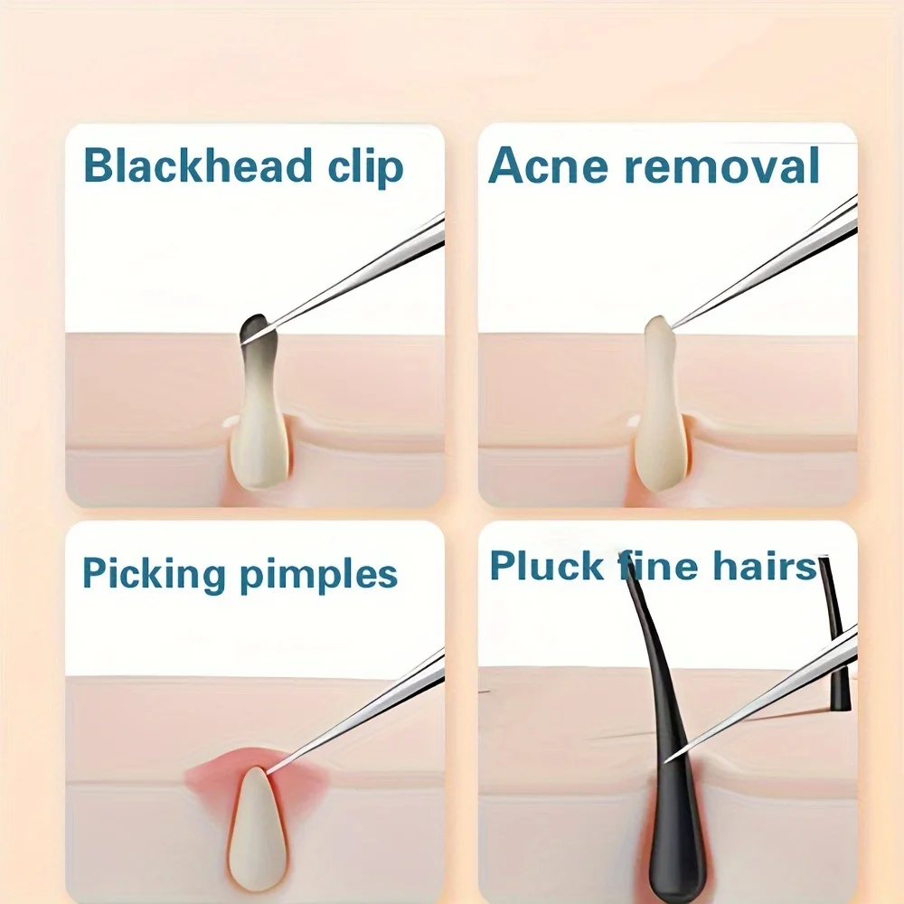 1/3 buah Kit jarum komedo dan Jerawat, alat perawatan wajah dengan pinset dan penjepit presisi yang lembut
