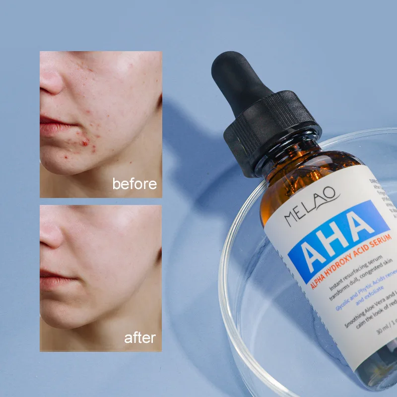 AHA Brightening Serum - Exfoliates & Hydrates for Refined Pores & Radiant Complexion