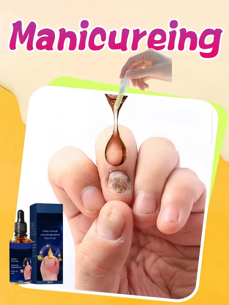 25 أداة فرشاة تنظيف الأظافر الساخنة، المكانس الكهربائية البلاستيكية، قل وداعًا لمشاكل الأظافر
