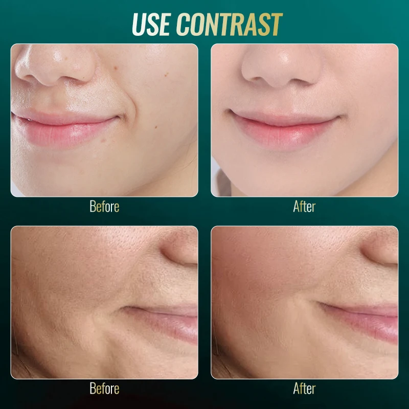 Masajeador eléctrico Gua sha multifuncional para levantamiento de rostro y cuello EMS vibración luz raspado masaje belleza Scrapi belleza