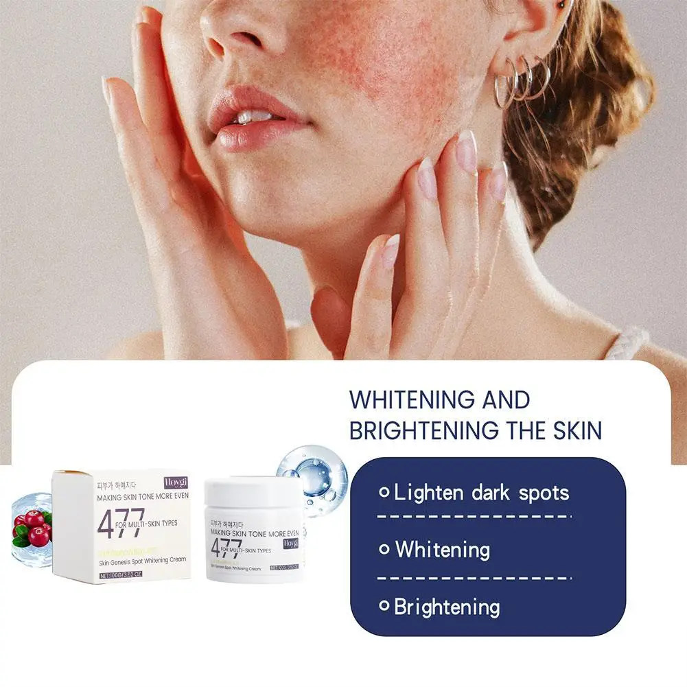 كريم تبييض نمش فعال ، تقليل الكلف ، تتلاشى بشكل ناعم في الظلام ، ترطيب ، بقع حب الشباب ، تفتيح البشرة ، E2x0