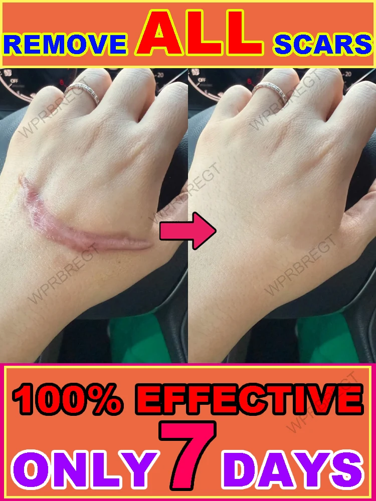 Want naturally flawless skin? Try this!