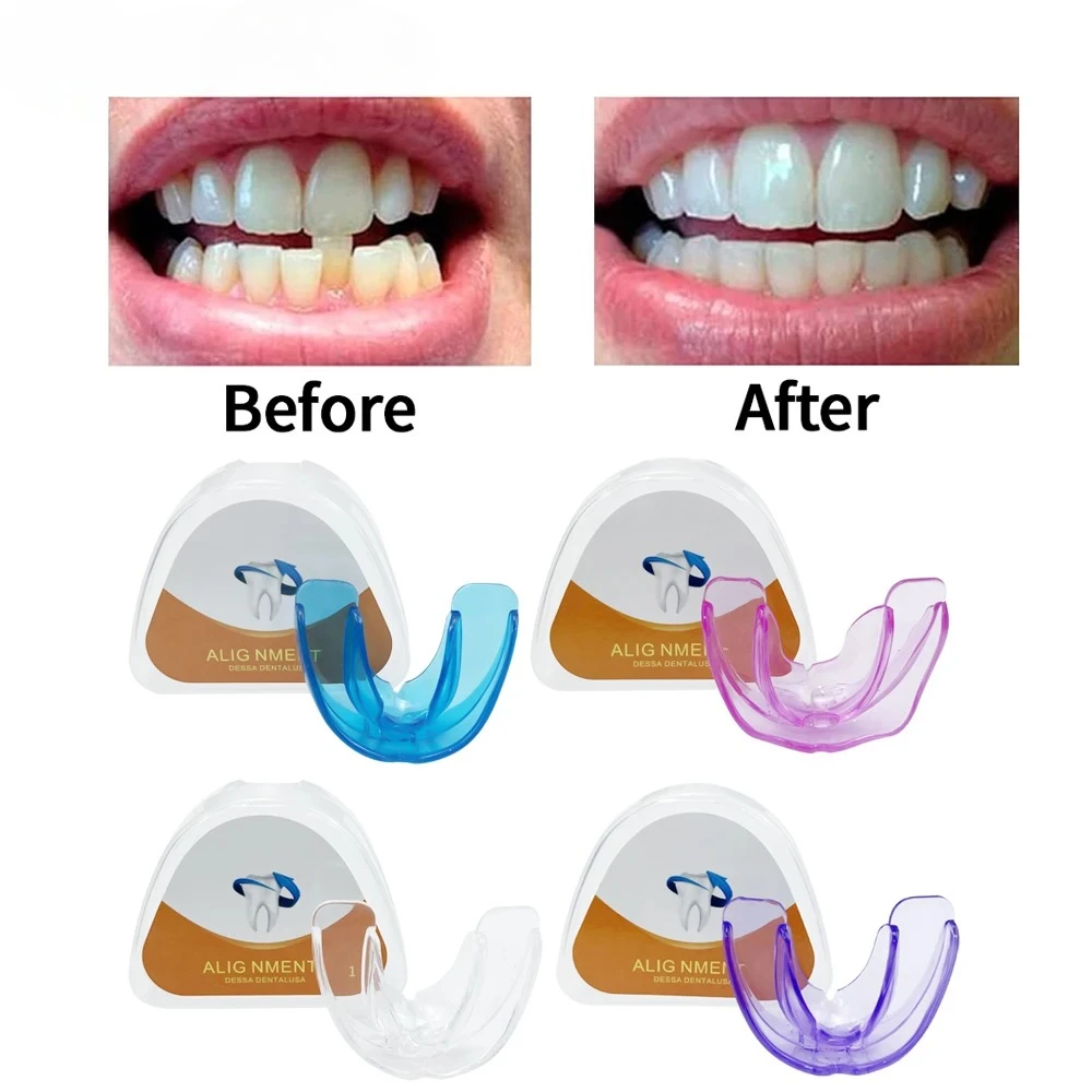 

Ортодонтические брекеты, стоматологические брекеты, тренажер для выравнивания зубов с улыбкой, мгновенный силиконовый фиксатор зубов, капа, брекеты для зубов 2026
