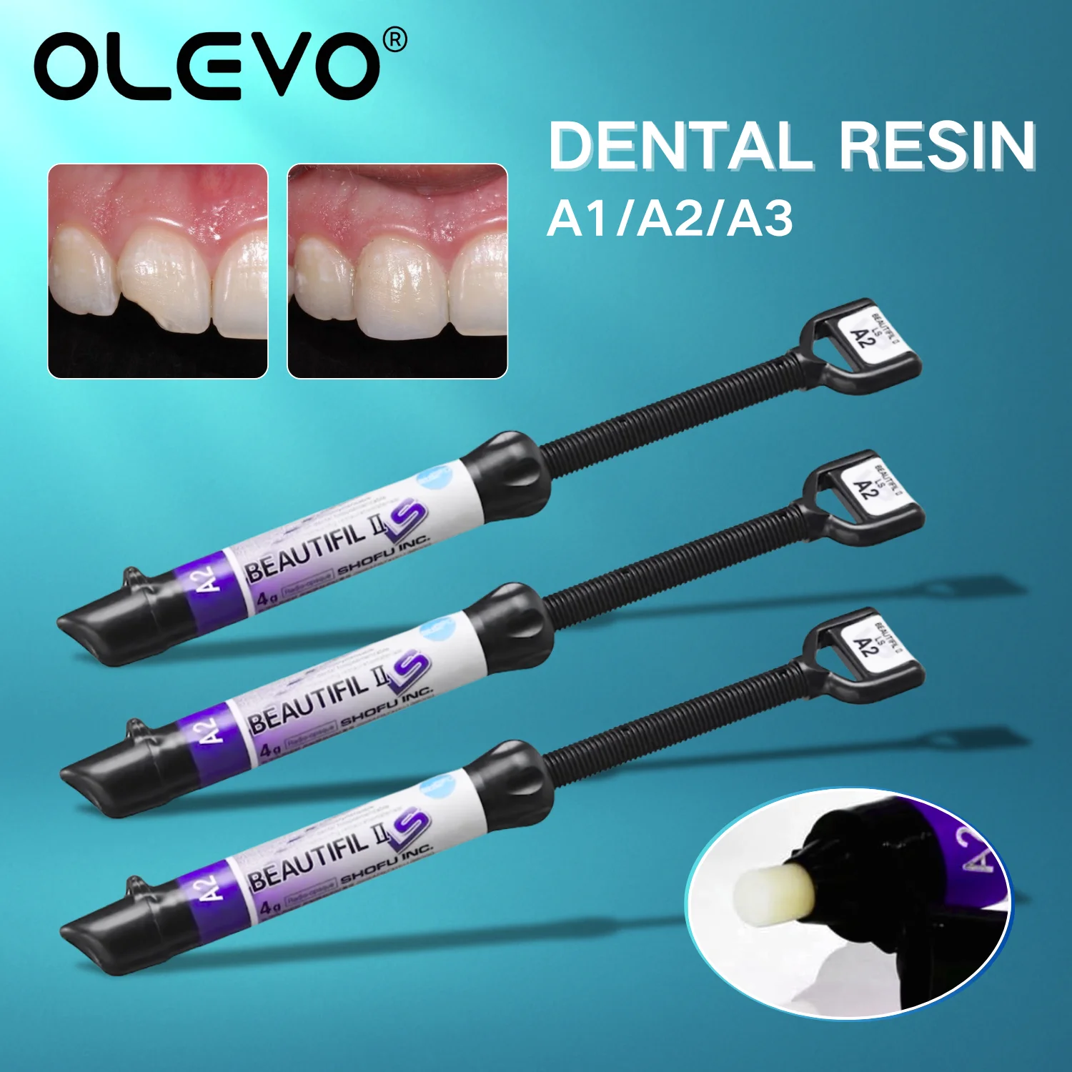 

4g/syringe Dental Aesthetic Composite Resin Low Shrinkage II LS Resin A1/A2/A3 Dentist Restoration Bonding Filling Materials