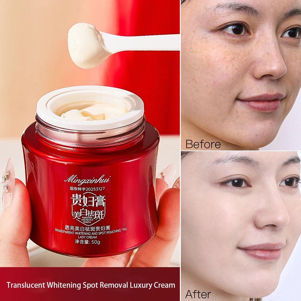 شفافة تبييض بقعة إزالة الماس الأحمر سيدة كريم تجديد الجلد ترطيب مغذي كريم وجه العناية بالبشرة الكورية #1