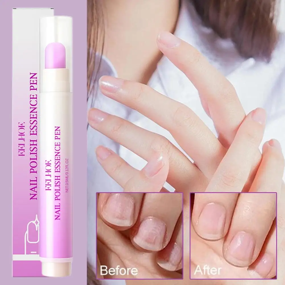 قلم إصلاح عدوى الأظافر مضاد لفرط الأظافر بارونيشيا اصفرار تحسين إزالة الفطريات القلم أظافر ملونة أظافر C H1I9 #3