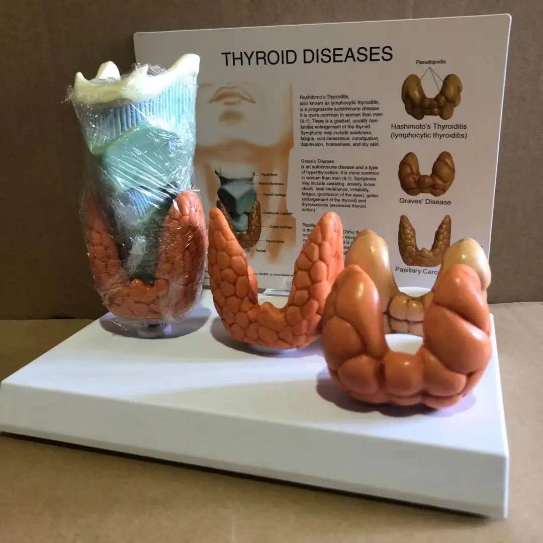 Thyroid Disease Anatomical Model 4D for Medical Teaching Display