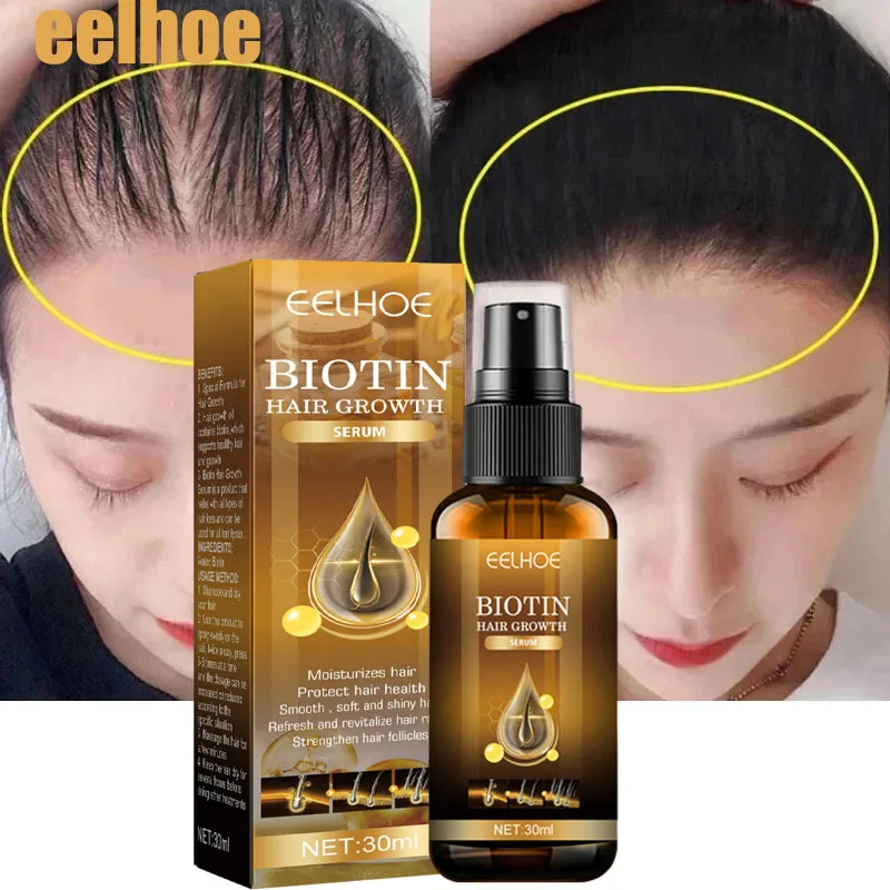 

Biotin Hair Growth Solution Hair Loss Repairing Beard Eyelash Growth Oil Serum Fast Hair Growth Serum For Men Ladies Spray 30ml