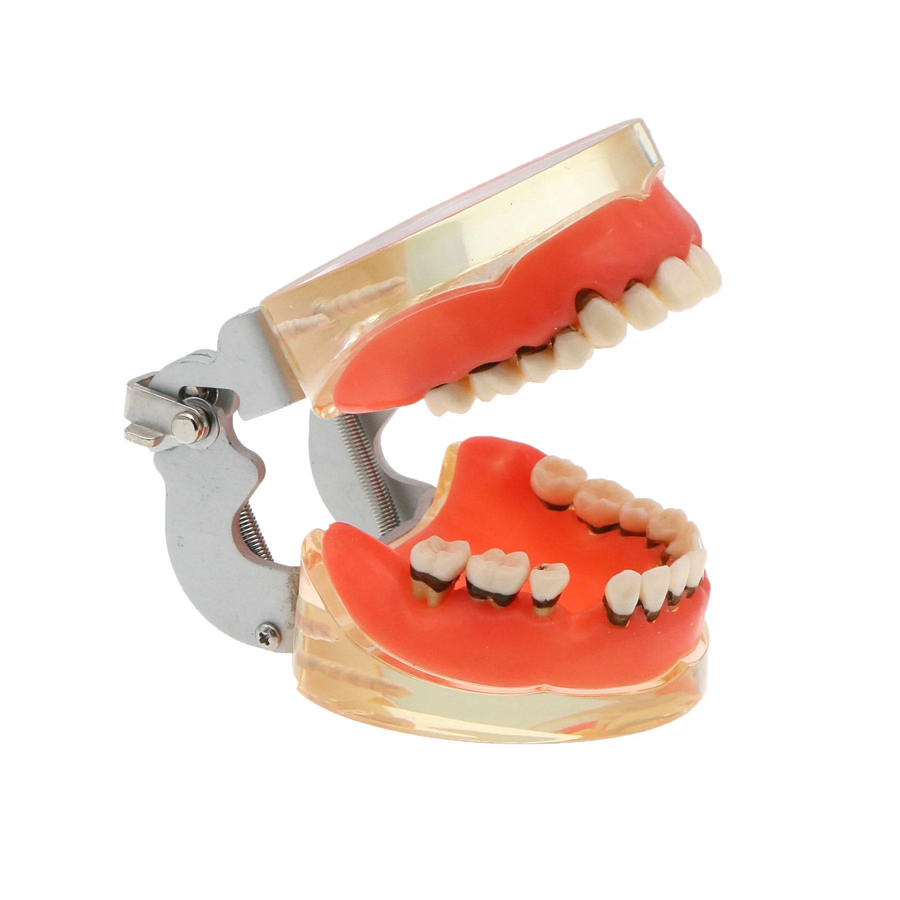 Dental Teeth Model Adult Pathological Periodontal Disease Study Teach Teeth M4017