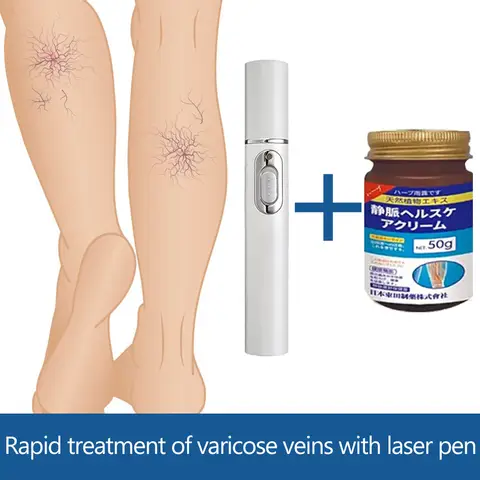 10 best sales वैरिकाज़ - №3