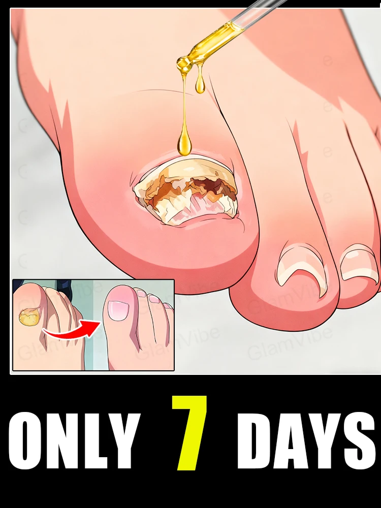 

manicure for bad Can in 7 days farewell Cleaning Nail Repair Pedicure Package Tools