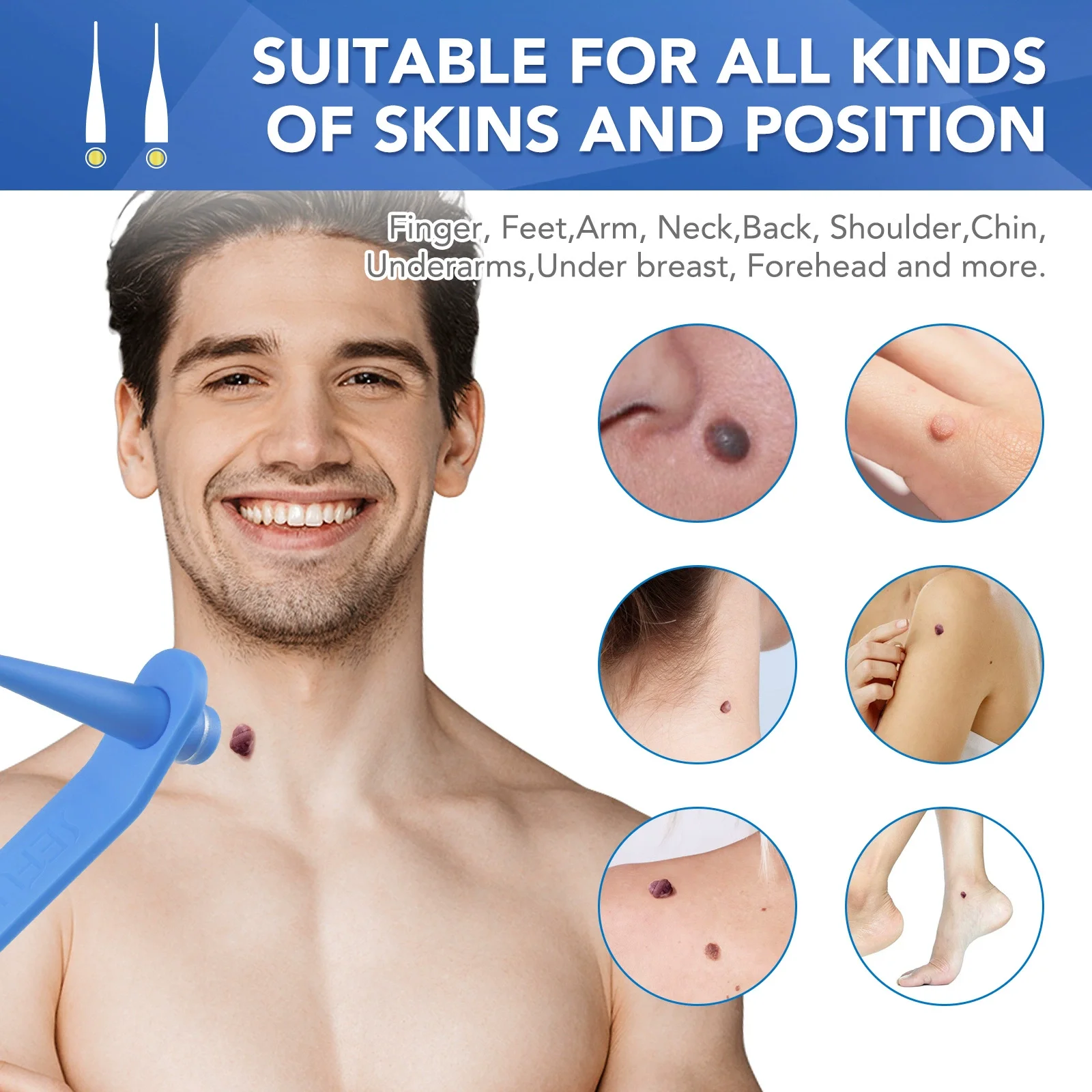 ชุดเครื่องมือกำจัดไฝและติ่งเนื้อผิวหนังแบบอัตโนมัติ 2 in 1 ไม่เจ็บปวด สำหรับติ่งเนื้อขนาดเล็กถึงใหญ่ 2-8 มม. อุปกรณ์กำจัดไฝและหูด สำหรับดูแลผิวหน้า
