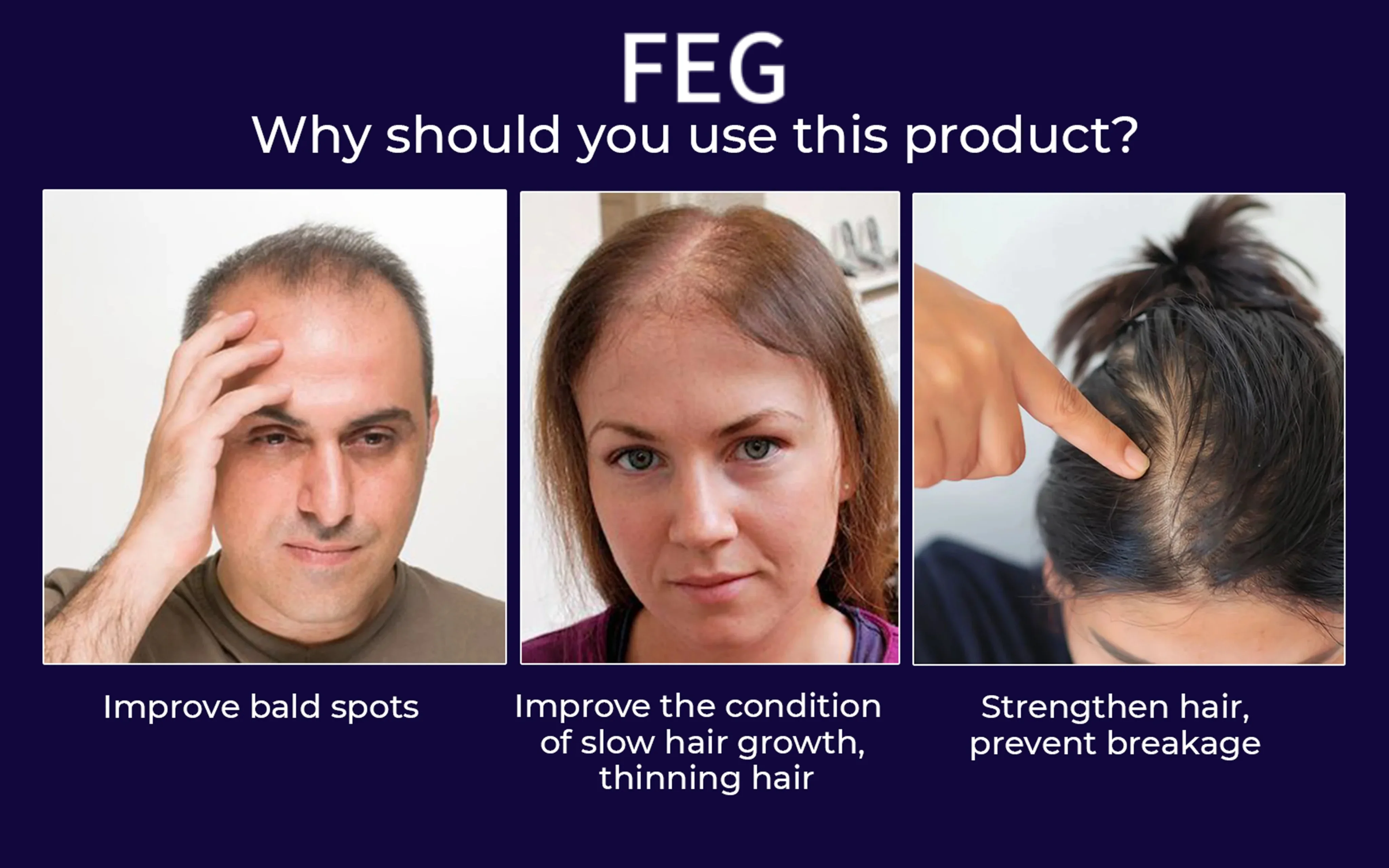 FEG Hair Sary - 50 مل اختيار سحري لتغذية الشعر، زجاجة رذاذ سهلة الحمل لتغذية محلول مغذي للشعر #4