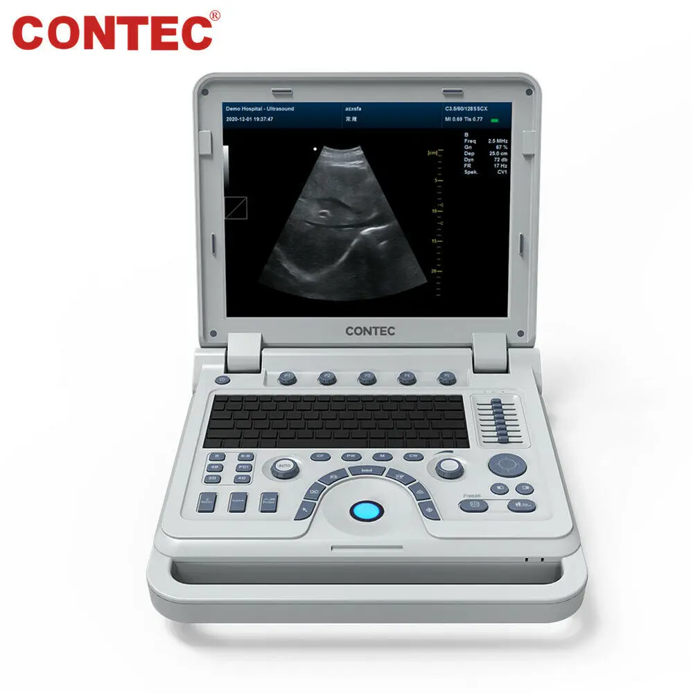 Ręczny system diagnostyczny ultradźwiękowy CONTEC Color Doppler CMS1700B