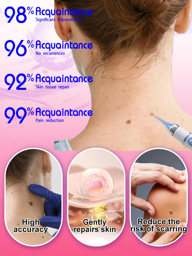 ʙʟᴜᴇ ʟɪɢʜᴛ ᴘᴇɴ sᴏʟᴠᴇ ᴡᴀʀᴛs, ʜᴏᴛ sᴀʟᴇ ᴡᴀʀᴛ ᴄᴀʀᴇ ᴛᴏᴏʟs