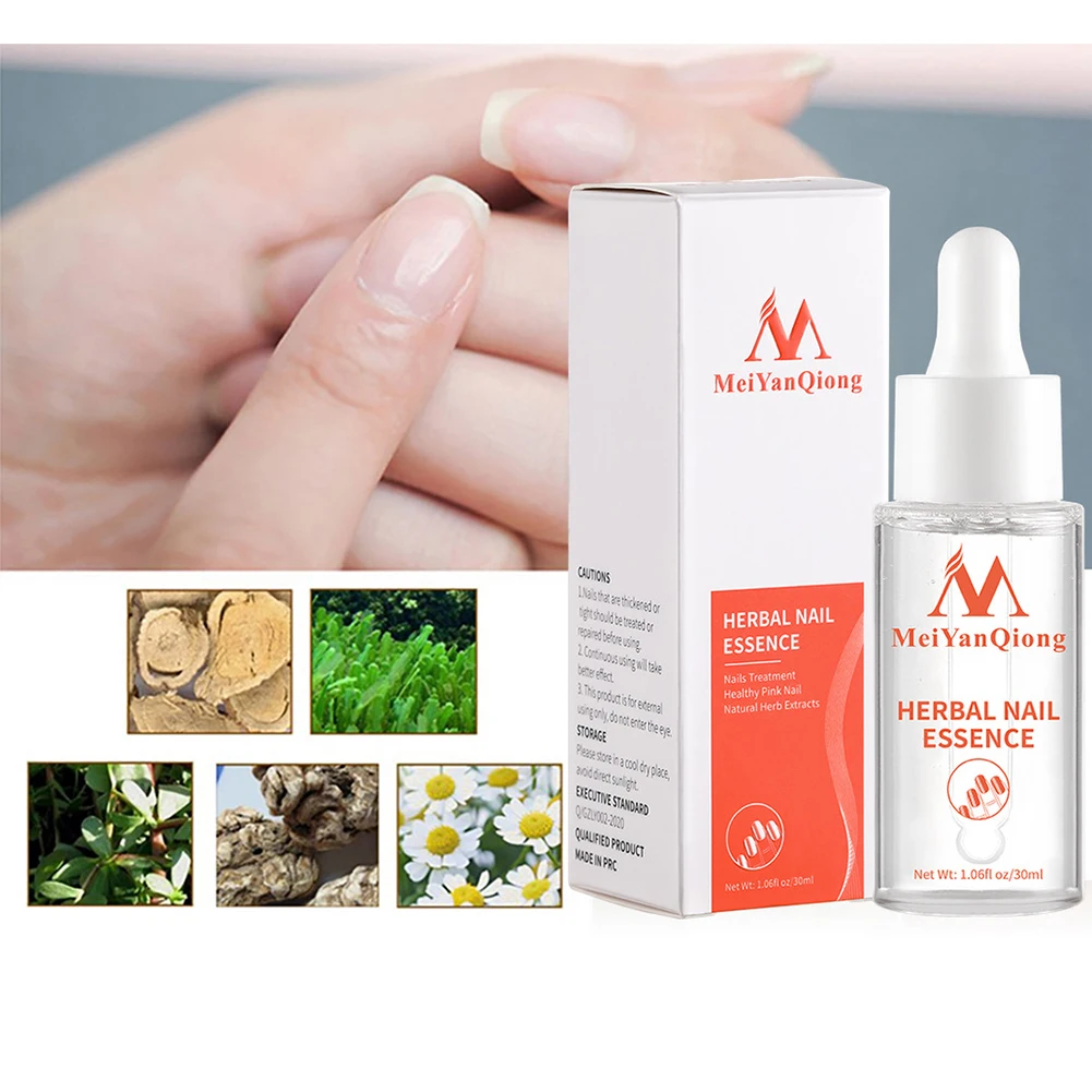 Feet Onychomycosis Repair Essence Anti Toe Nails Removal Gel Effective Toe Paronychia Repair Gel