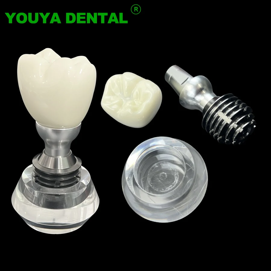 Dental Implant Demonstration Model Single Tooth Crown Crystal Base Teeth Study Teaching Model Dentistry Demonstration Models