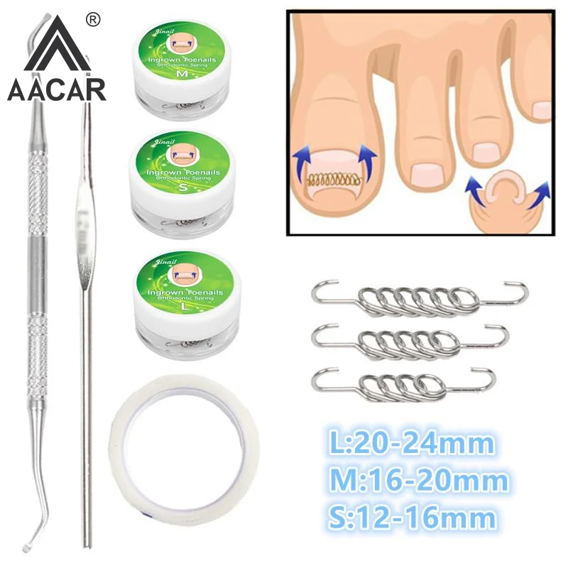 Ingrown Toenail Cor…