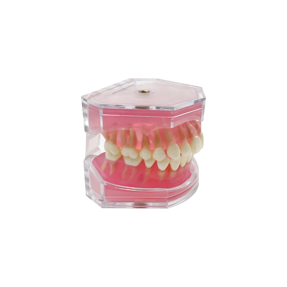 With Removable Dental Model Standard Jaw Typodont Soft Gum Dental Extraction Teaching Demonstration Transparent Model