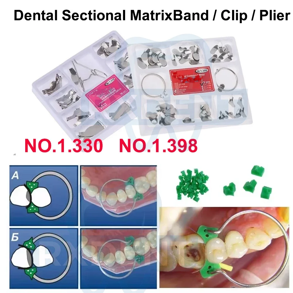 Dental Matrix Sectional Contoured Matrices Metal Stainless Steel Matrix Sectional Contoured Dentistry Laboratory Material