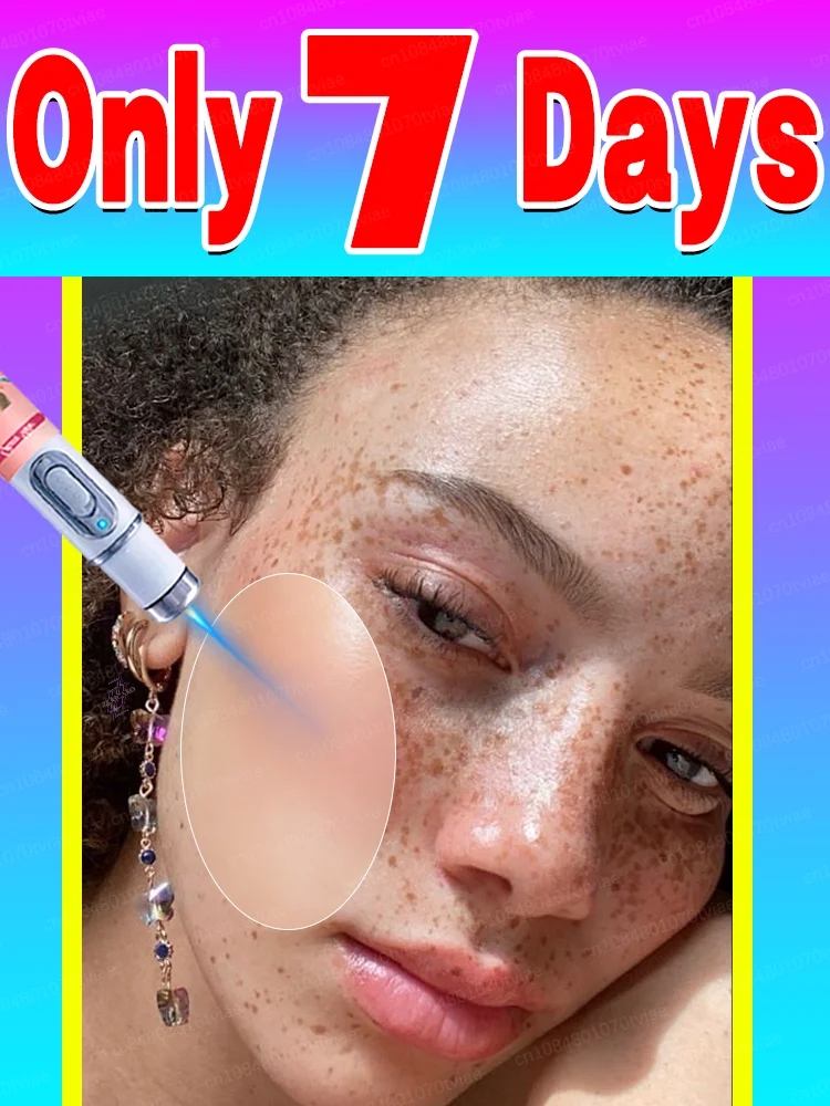 

Pigmentation fades away, Skin care tools reveal flawless skin once more.Rᴇᴍᴏᴠᴇ ᴠᴀʀɪᴏᴜs sᴘᴏᴛs