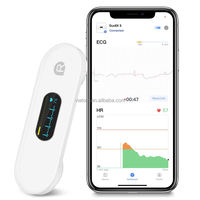 Pocket ECG Monitoring Device with OLED Screen Bluetooth EKG Monitor for Rhythm Waveform, Free APP AI Analyze with iOS/Android