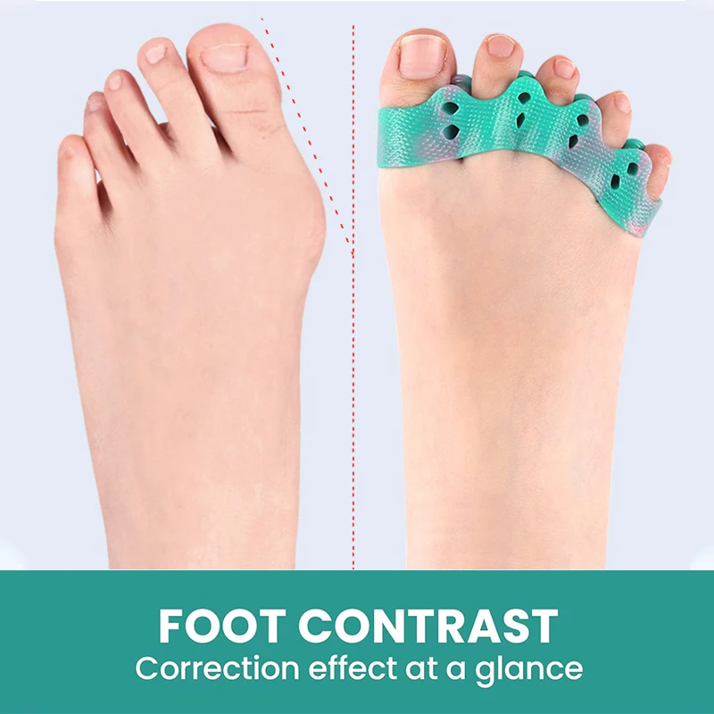 ペックスメン 2個入り トゥセパレーター トゥースペーサー 男女兼用 外反母趾矯正と足の形の復元