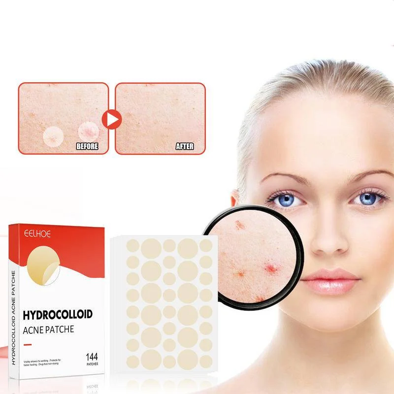 144pcs Invisible Acne Patch Hydrocolloid Anti-Acne Concealer Removal Pimple Transparent Zit Patch Sticker Skin Care