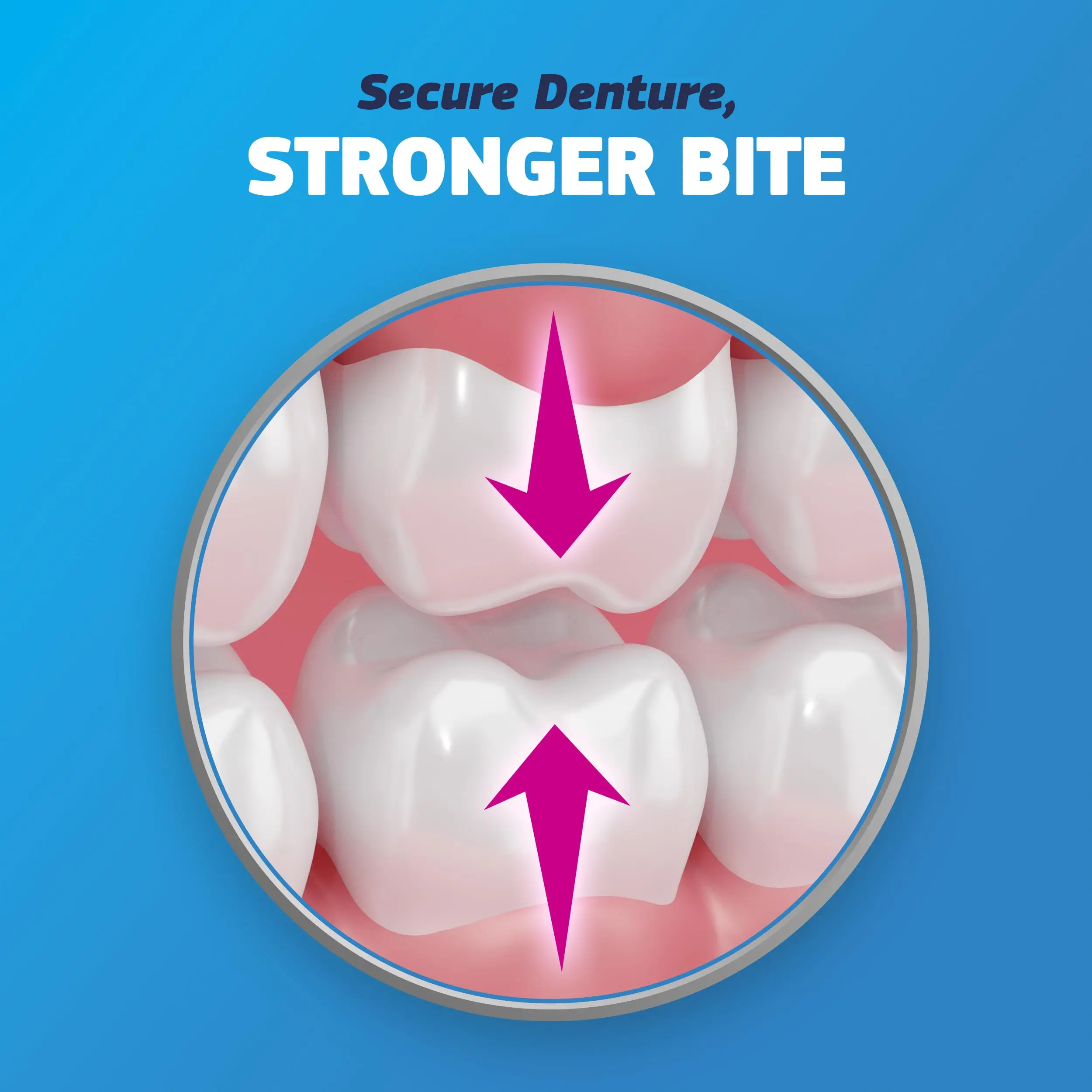 Thermoplastic Denture Adhesive – Tightens Loose Dentures, Relines for Secure Comfort Fit, Cushions Gums, Waterproof & Zinc-Free