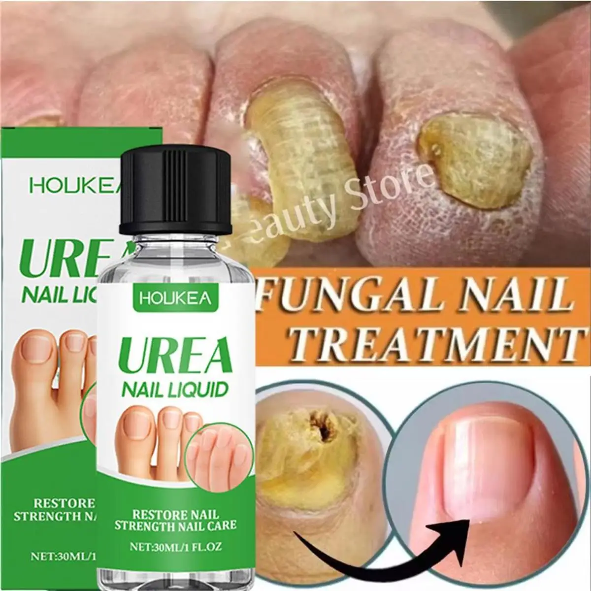 

Fungal Nail Treatment Essence Oil Nail Fungus Laser Device Repair Toenail Fingernail Ginger Treatment Hand Foot Essence Liquid