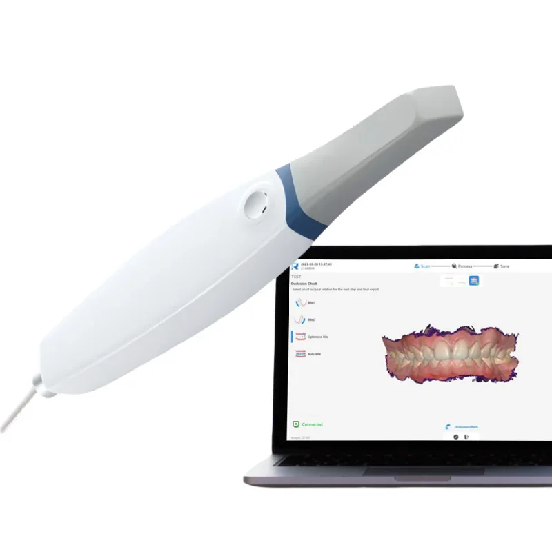 Original Dental Scanner Digital 3DS USB 3.0 Pro Oral Scanner CAD CMD Scanning Software Oral Therapy Equipment