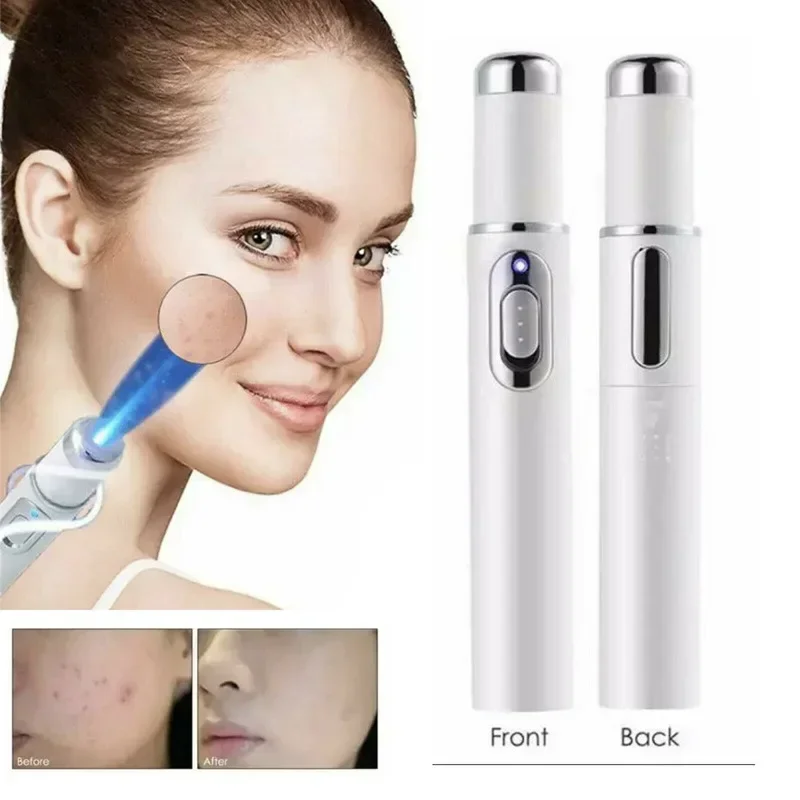 Blue Light Therapy Wrinkle Acne Removal Laser Pen Skin Spots Removal Beauty Machine Anti Varicose Spider Vein Eraser Treatment