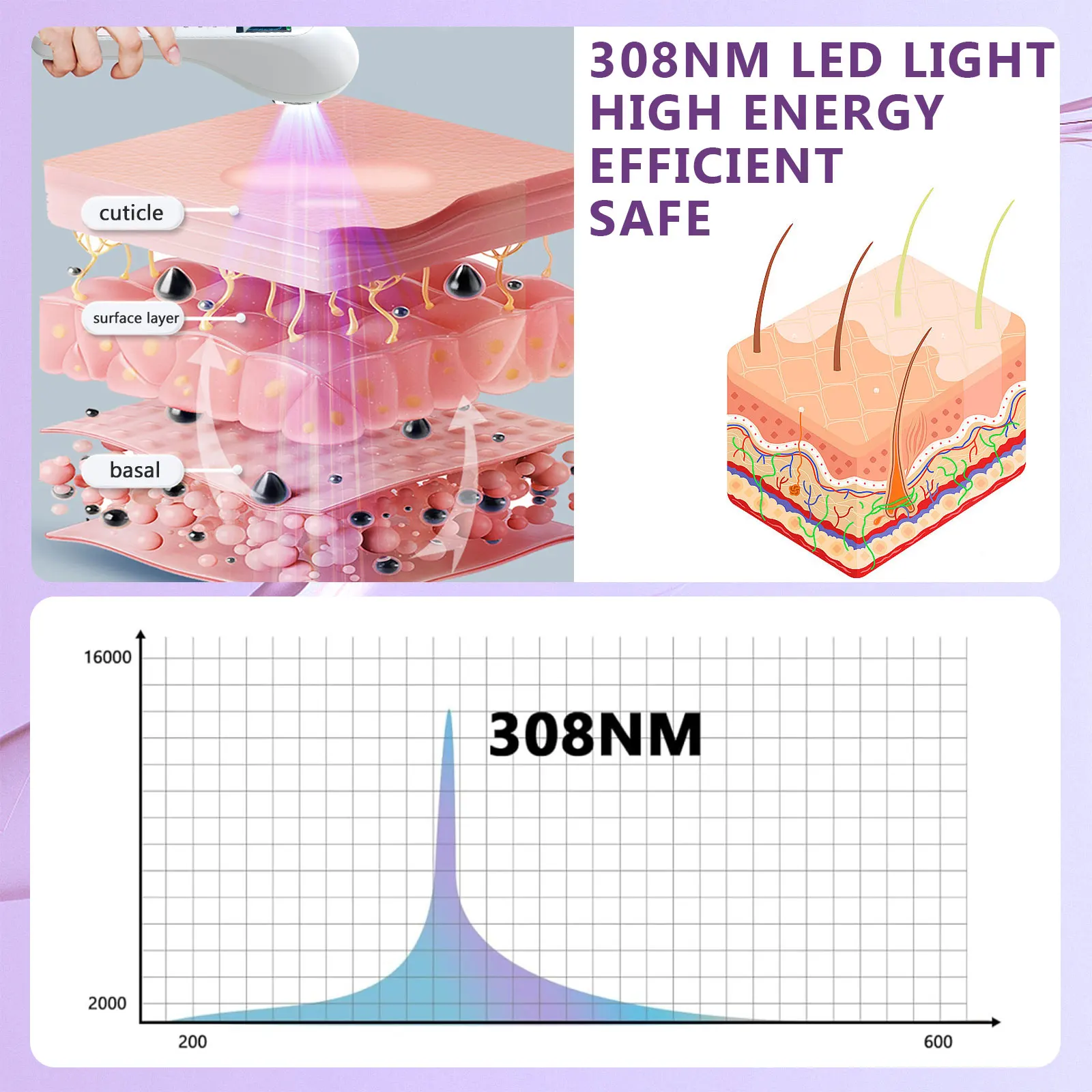 KTS UVB جهاز مصباح العلاج بالضوء لعلاج البهاق 308NM UV ضيق النطاق الأشعة فوق البنفسجية العلاج بالضوء الصدفية البقع الأكزيما #2