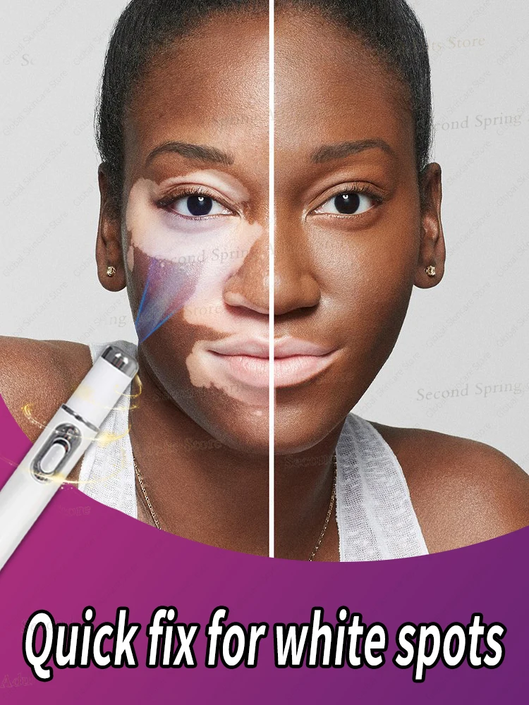 

Remove whitening spot