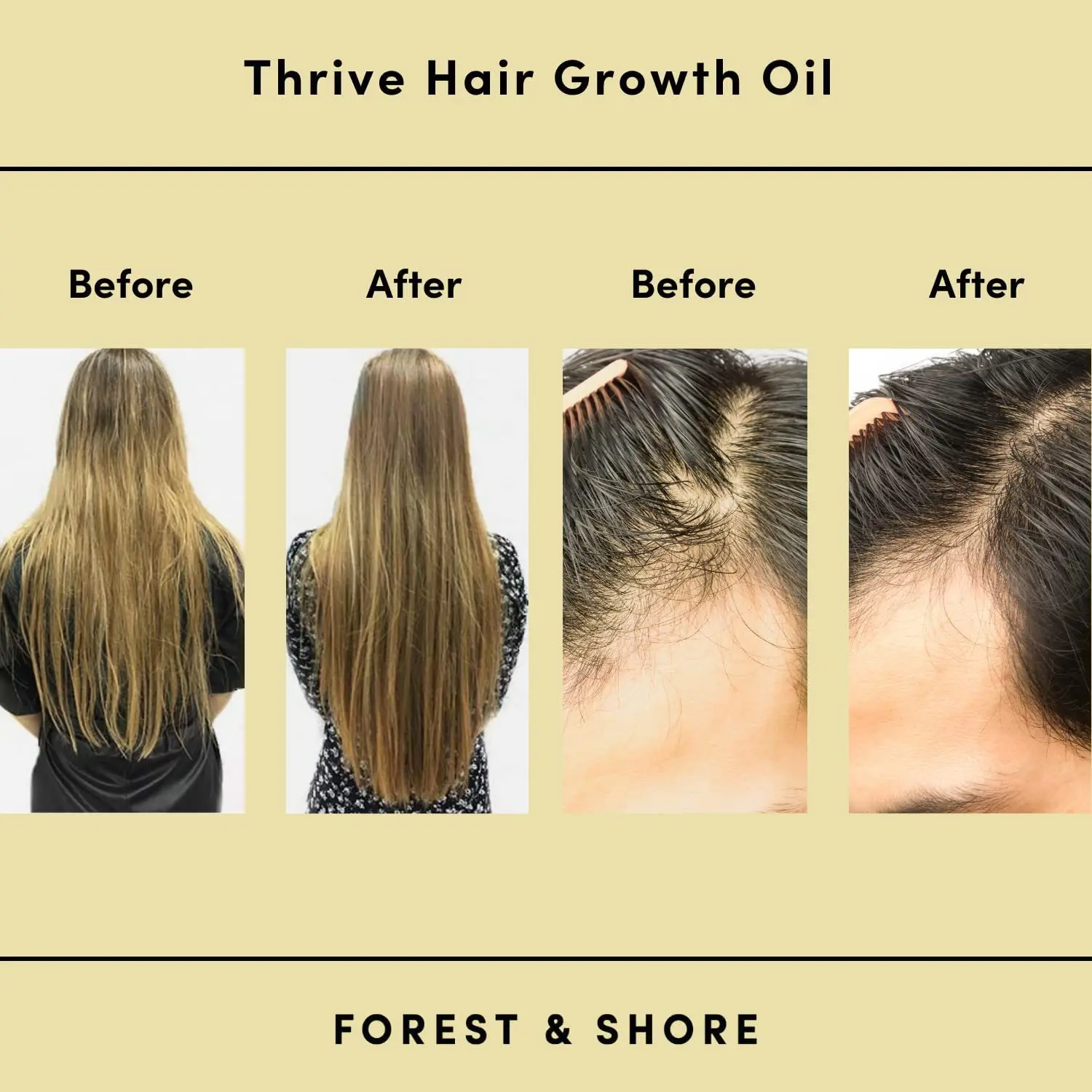 Promote Hair Regrowth Natural Fast Growth Oil with Castor Argan Oil To Encourage Fuller Hair Thickening for Hair Loss 탈모 60ml