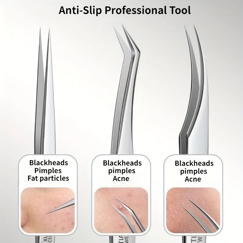 مجموعة إبر مطورة مكونة من 3 قطع، إبرة الرؤوس السوداء، أداة إزالة البثور للاستخدام المنزلي، تصميم مقاوم للخدش، البثور/الرؤوس السوداء/الرؤوس البيضاء #6