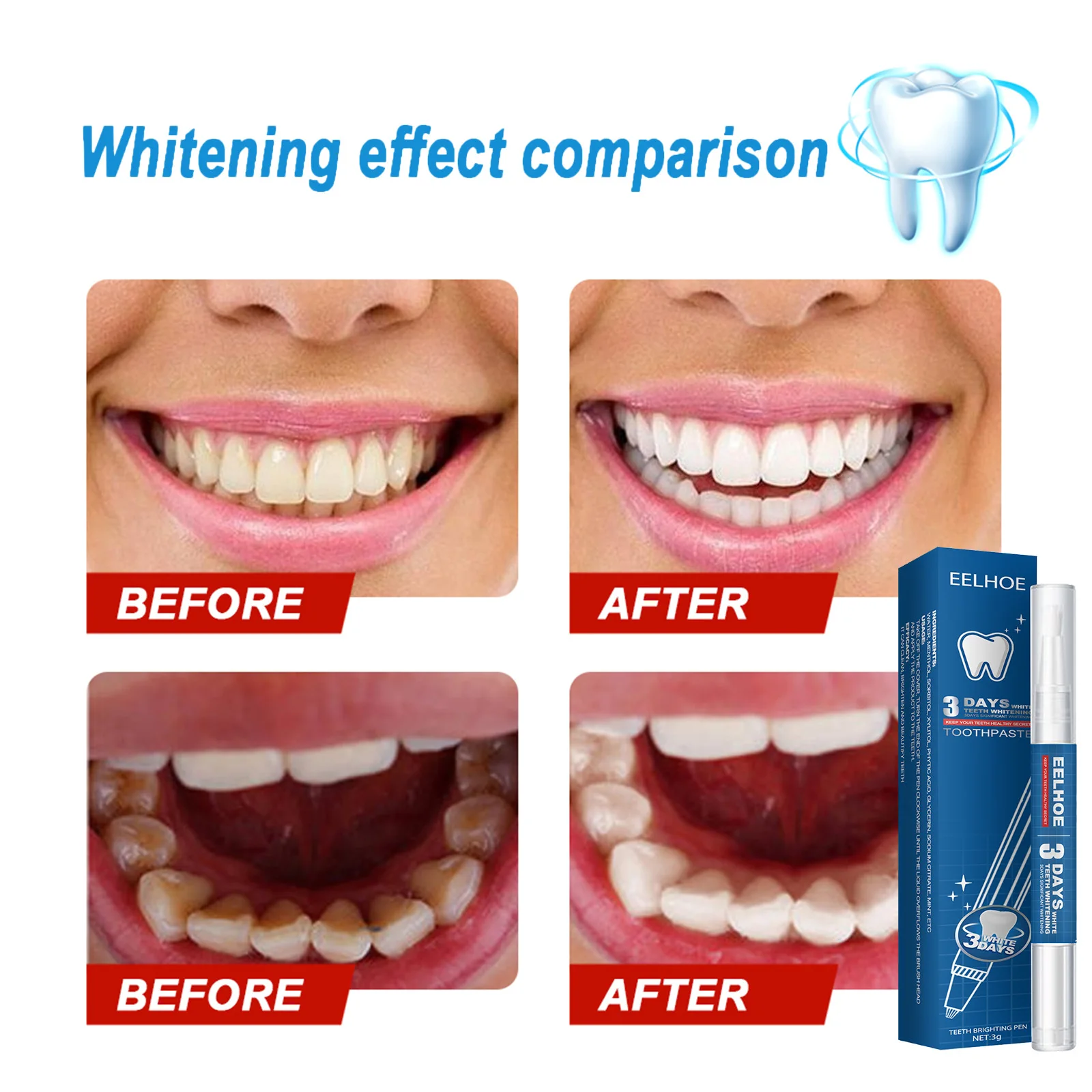 EELHOE Toothpaste Pen Teeth Whitening Gel Tooth Stain Remover Smoke Stain Whitening Gum Repair Oral Cleaning Dental Care Essence