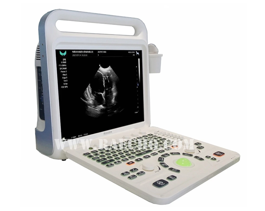 Raecho RU-X60 Color Doppler Ultrasound Scanner Portable