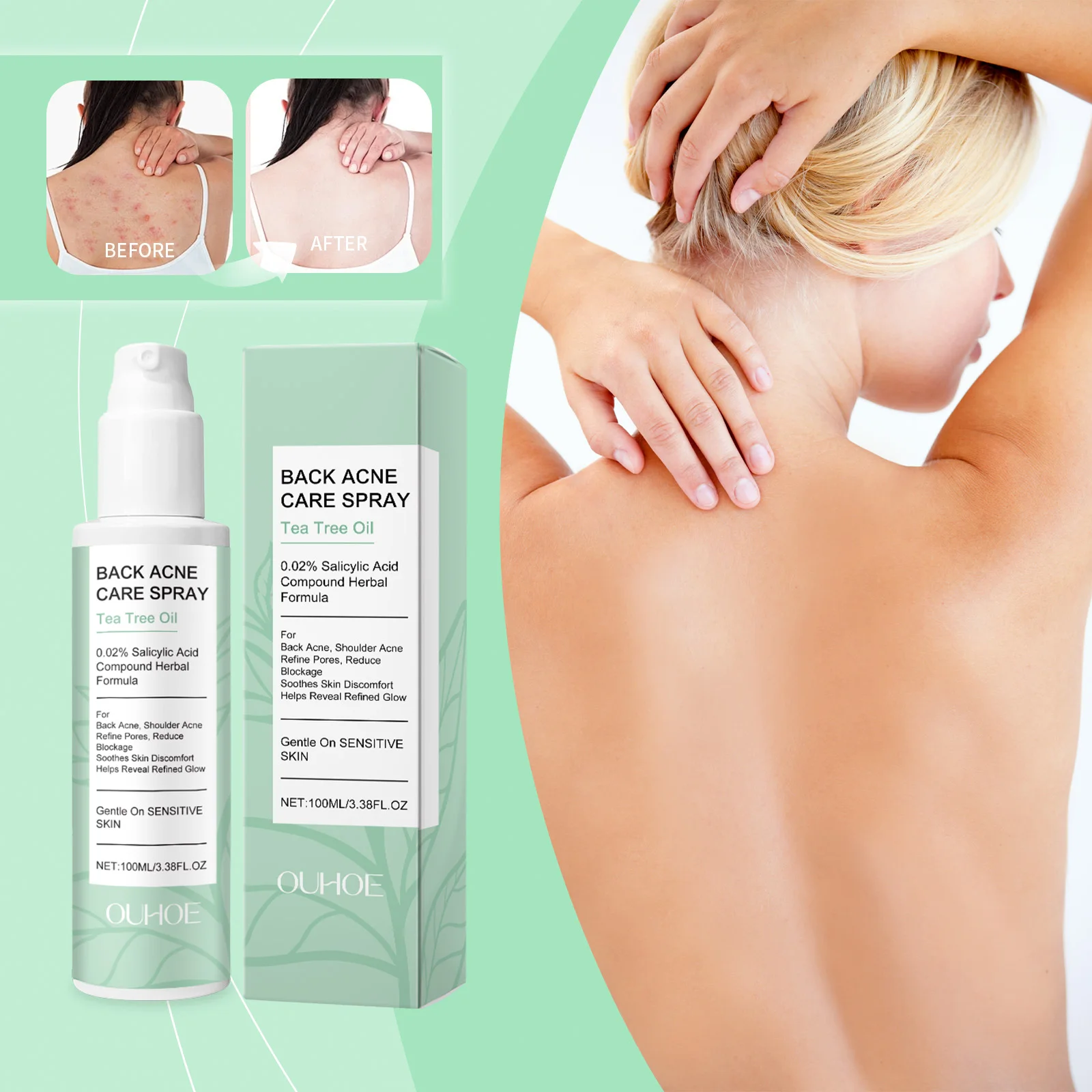 OUHOE Back Acne Care Spray Salicylic Acid Soothing Repair Body Spray Oil Control Moisturizing Gentle Anti-Acne Spray Cares Body