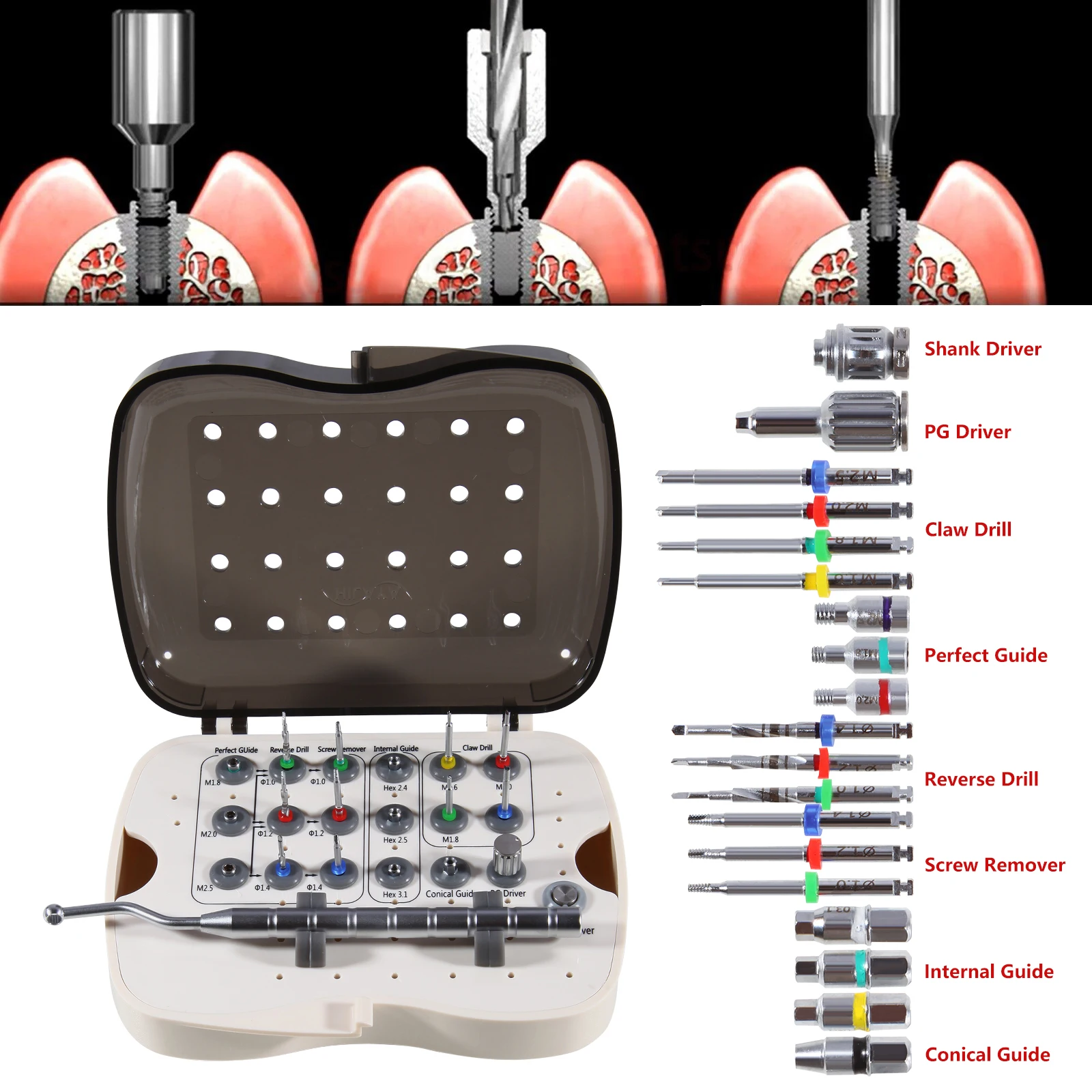 Dental Implant Screw Removal Kit Broken Remover Surgery Kit Reverse Drill Guide Driver NeoBiotech Universal Dentist Tools